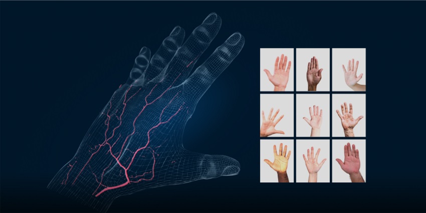 We can change the game in terms of how people think about palm vein technology